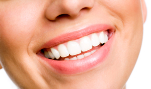 Woman showing beautiful healthy teeth in her smile