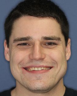 TMJ Treatment