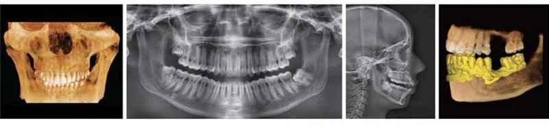 Green CT 2 four types of images: pano, cepth, cbct and model