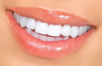 teeth after whitening