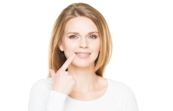 Attractive teenage girl smiling in dental braces. Stomatology concept.